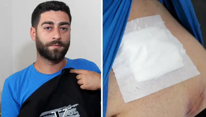 Karnındaki Ağrı, Röntgenle Ortaya Çıkan Şaşırtıcı Gerçeği Ortaya Çıkardı