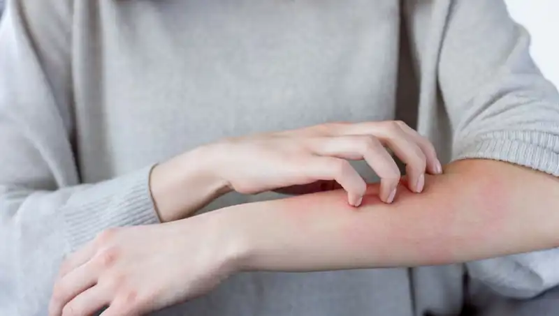 Cilt Kanserinin Belirtilerini Kaçırmayın: Dermatologdan Önemli Açıklamalar