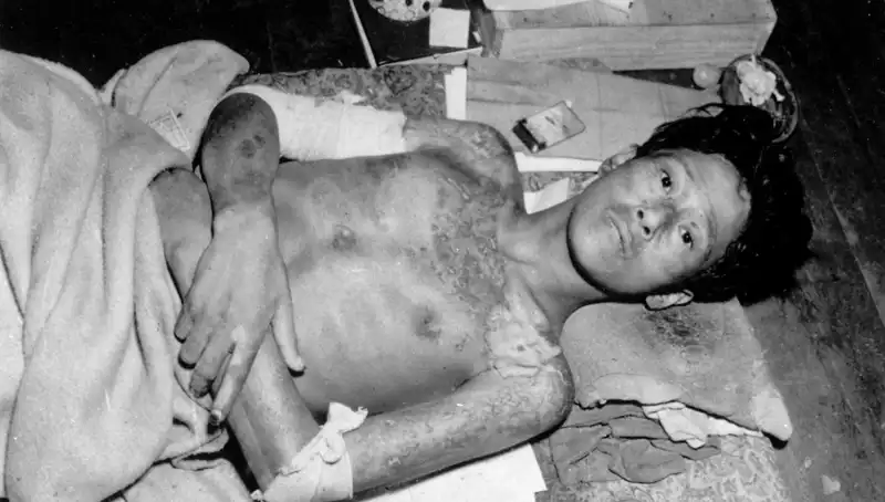 Nagasaki’den Yükselen Ses: Nükleer Tehditler 80 Yıl Sonra Yeniden Gün Yüzünde!